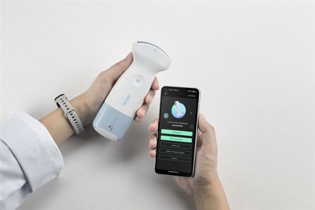 The LU800 Handheld Ultrasound