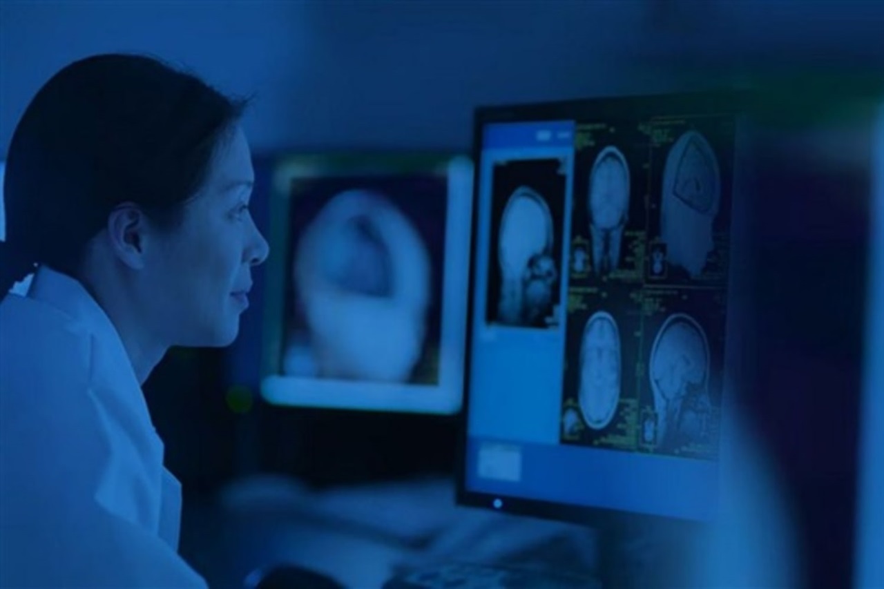 Japan targets 2nm medical AI chip with IBM design, Rapidus eyed for foundry